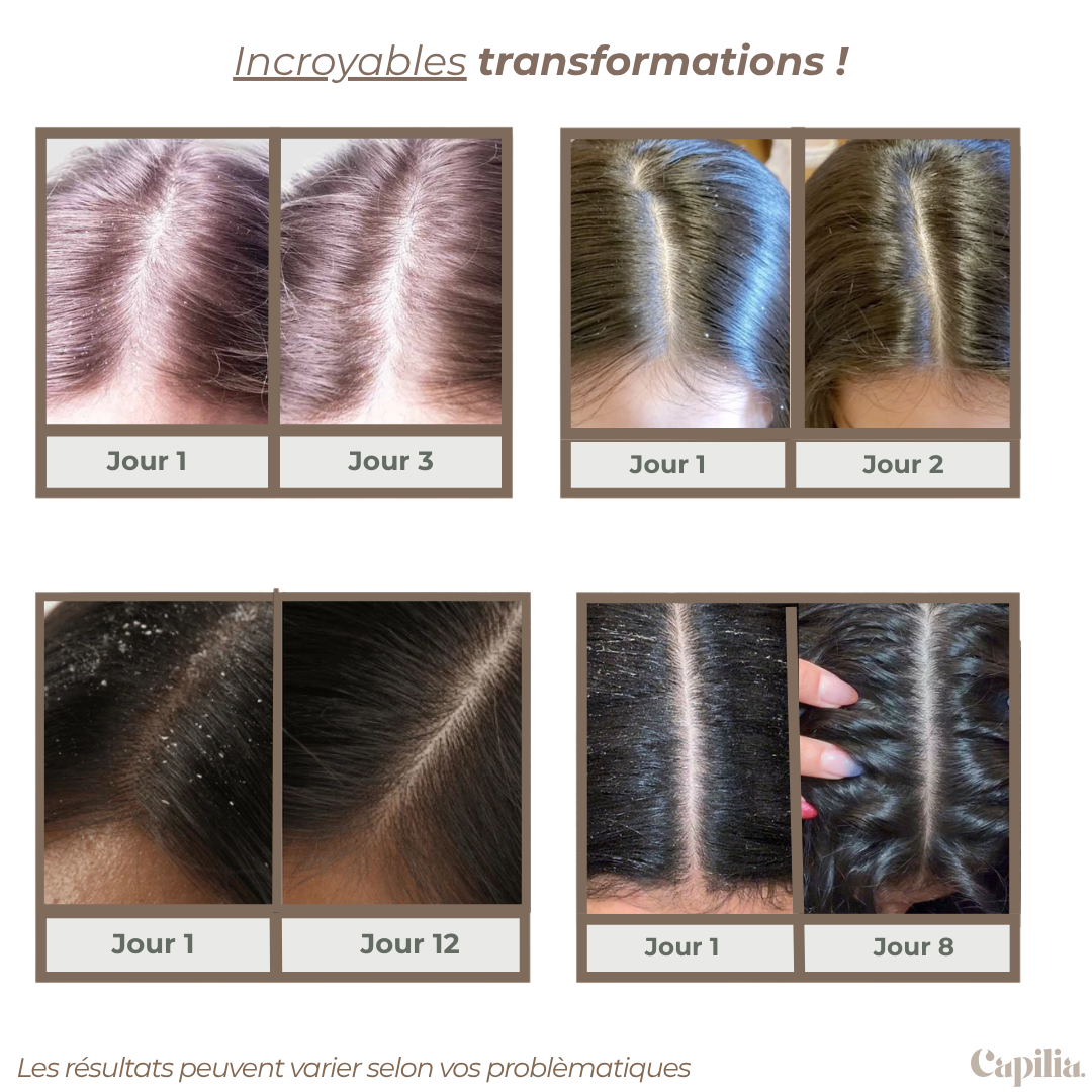 Peigne antipelliculaire